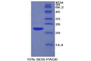 SDS-PAGE (SDS) image for PC4 and SFRS1 Interacting Protein 1 (PSIP1) (AA 311-469) protein (His tag) (ABIN2125623)