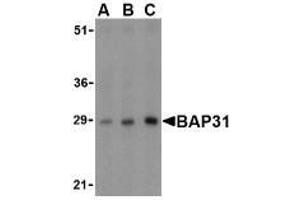 Western blot analysis of BAP31 in rat lung tissue lysate with AP30124PU-N BAP31 antibody at (A) 0.