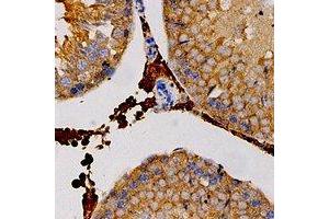 Immunohistochemical analysis of Carbonic Anhydrase 3 staining in human testis formalin fixed paraffin embedded tissue section. (CA3 antibody)