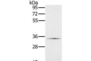 Western Blot analysis of Hela cell using NDUFA9 Polyclonal Antibody at dilution of 1:400 (NDUFA9 antibody)