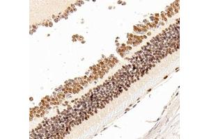 Immunohistochemistry (Paraffin-embedded Sections) (IHC (p)) image for anti-Orthodenticle Homeobox 2 (OTX2) antibody (ABIN7074952)