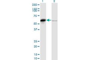 Western Blot analysis of SERBP1 expression in transfected 293T cell line by PAI-RBP1 monoclonal antibody (M01), clone 1D2-2E9. (SERBP1 antibody  (AA 1-402))