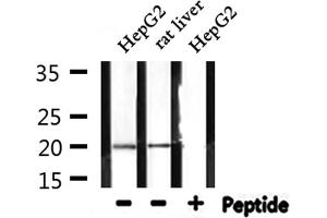 Western blot analysis of extracts from HepG2 and rat liver, using RPL27A Antibody.