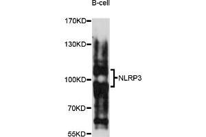 Western blot analysis of extracts of B-cell cells, using NLRP3 antibody (ABIN5973297) at 1/1000 dilution. (NLRP3 antibody)