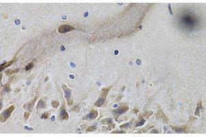 Immunohistochemistry of paraffin-embedded Mouse brain using NTRK1 Polyclonal Antibody at dilution of 1:100 (40x lens).