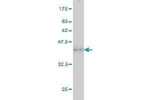 Western Blotting (WB) image for anti-Replication Factor C (Activator 1) 1, 145kDa (RFC1) (AA 1-110) antibody (ABIN562632)