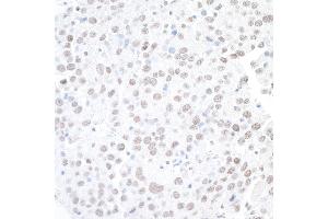 Immunohistochemistry (IHC) image for anti-Actin-Like 6A (BAF53A) (AA 25-75) antibody (ABIN7453898) (BAF53A antibody  (AA 25-75))
