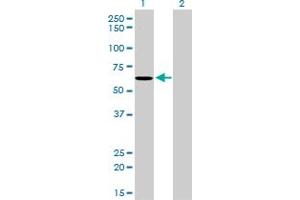 Western Blot analysis of NDOR1 expression in transfected 293T cell line by NDOR1 monoclonal antibody (M01), clone 3A11. (NDOR1 antibody  (AA 498-595))