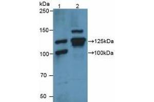Figure. (Vinculin antibody  (AA 1020-1134))