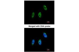 ICC/IF Image Immunofluorescence analysis of paraformaldehyde-fixed HeLa, using ELP3, antibody at 1:100 dilution. (ELP3/KAT9 antibody  (Center))