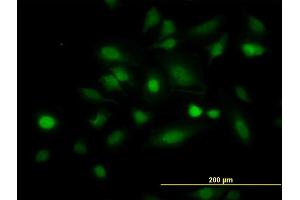 Immunofluorescence of monoclonal antibody to STAT5B on HeLa cell. (STAT5B antibody  (AA 678-787))