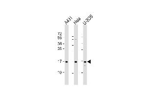Western Blot at 1:2000 dilution Lane 1: A431 whole cell lysate Lane 2: Hela whole cell lysate Lane 3: U-2OS whole cell lysate Lysates/proteins at 20 ug per lane. (RPLP1 antibody  (AA 18-49))