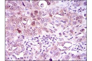 Immunohistochemistry (IHC) image for anti-ATP Citrate Lyase (ACLY) (AA 306-502) antibody (ABIN1842880) (ACLY antibody  (AA 306-502))