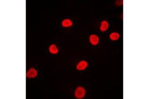 Immunofluorescent analysis of hnRNP F staining in Jurkat cells. (HNRNPF antibody  (N-Term))