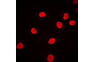 Immunofluorescent analysis of hnRNP F staining in Jurkat cells.