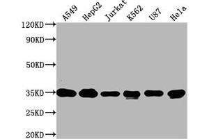Western Blot Positive WB detected in: A549 whole cell lysate, HepG2 whole cell lysate, Jurkat whole cell lysate, K562 whole cell lysate, U87 whole cell lysate, Hela whole cell lysate All lanes: SUMF2 antibody at 1:2000 Secondary Goat polyclonal to rabbit IgG at 1/50000 dilution Predicted band size: 34, 25, 38, 24, 35 kDa Observed band size: 34 kDa (SUMF2 antibody  (AA 26-301))
