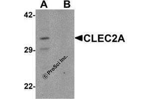 Western Blotting (WB) image for anti-C-Type Lectin Domain Family 2, Member A (CLEC2A) (N-Term) antibody (ABIN1031323) (CLEC2A antibody  (N-Term))