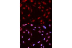 Immunofluorescence analysis of MCF-7 cells using Phospho-CHEK1-S280 antibody (ABIN5969878). (CHEK1 antibody  (pSer280))