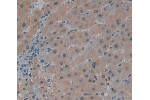 Used in DAB staining on fromalin fixed paraffin- embedded liver tissue (Centriolin antibody  (AA 2101-2325))