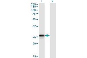 Western Blot analysis of HLA-DQB2 expression in transfected 293T cell line by HLA-DQB2 monoclonal antibody (M01), clone 4C3.