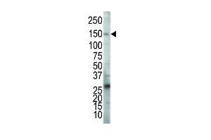 VEGFR2/CD309 antibody  (C-Term)