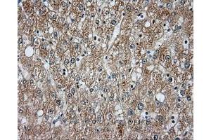 Immunohistochemical staining of paraffin-embedded liver tissue using anti-BTK mouse monoclonal antibody. (BTK antibody)