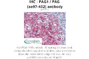 Image no. 1 for anti-phosphoprotein Associated with Glycosphingolipid Microdomains 1 (PAG1) (AA 97-432) antibody (ABIN1737819) (PAG1 antibody  (AA 97-432))