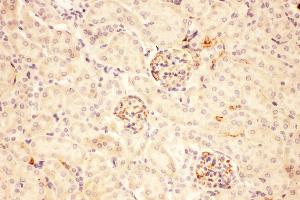 Anti-ACTH Picoband antibody,  IHC(P): Mouse Kidney Tissue (POMC antibody  (Middle Region))