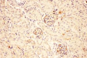Anti-ACTH Picoband antibody,  IHC(P): Mouse Kidney Tissue (POMC antibody  (Middle Region))