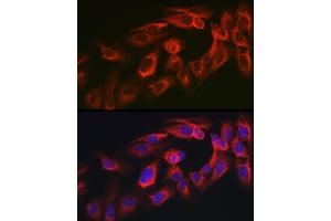 Immunofluorescence analysis of U2OS cells using MYO10 antibody (ABIN6128319, ABIN6144271, ABIN6144274 and ABIN6216113) at dilution of 1:350. (Myosin X antibody  (AA 845-944))