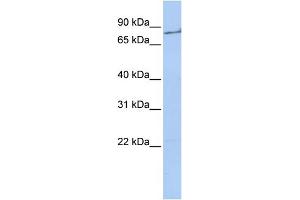 WB Suggested Anti-F2 Antibody  Titration: 1 ug/ml Positive Control: 721_B cell lysate (Prothrombin antibody  (Middle Region))