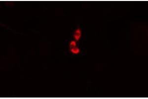 ABIN6274976 staining HepG2 cells by IF/ICC. (COMT antibody  (N-Term))
