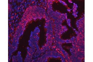 IF analysis of ARL1 using anti-ARL1 antibody (ABIN7602848). (ARL1 antibody  (C-Term))