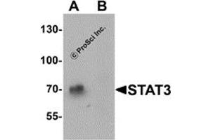 Western Blotting (WB) image for anti-Signal Transducer and Activator of Transcription 3 (Acute-Phase Response Factor) (STAT3) (N-Term) antibody (ABIN1077432) (STAT3 antibody  (N-Term))