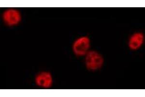 ABIN6274894 staining HepG2 by IF/ICC. (DQX1 antibody  (Internal Region))