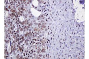 Image no. 1 for anti-Decapping Enzyme, Scavenger (DCPS) antibody (ABIN1497781) (DCPS antibody)