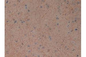 DAB staining on IHC-P; Samples: General Stomach Tissue) (GIP antibody)