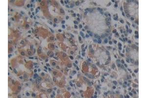 Detection of MMP14 in Human Stomach Tissue using Polyclonal Antibody to Matrix Metalloproteinase 14 (MMP14) (MMP14 antibody  (AA 322-541))