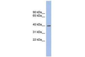 Image no. 1 for anti-GLI Family Zinc Finger Protein 4 (GLI4) (AA 71-120) antibody (ABIN6744509)