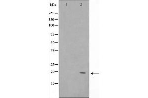 Western blot analysis on K562 cell lysate using COX42 Antibody，The lane on the left is treated with the antigen-specific peptide. (COX4I2 antibody  (Internal Region))
