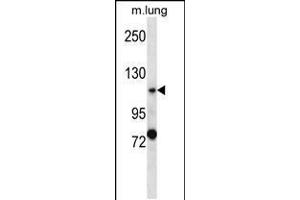 Western blot analysis in mouse lung tissue lysates (35ug/lane). (PKD2 antibody  (C-Term))