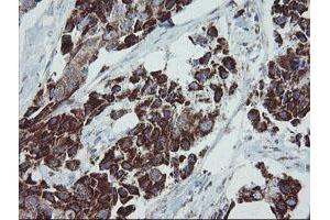 Image no. 2 for anti-Mitochondrial Ribosomal Protein S27 (MRPS27) (AA 151-414) antibody (ABIN1490963) (MRPS27 antibody  (AA 151-414))