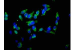 Immunofluorescence staining of Hela cells with ABIN7152369 at 1:100, counter-stained with DAPI. (Ezrin antibody  (AA 1-251))