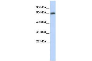 UGT2B15 antibody used at 1 ug/ml to detect target protein. (UGT2B15 antibody  (N-Term))