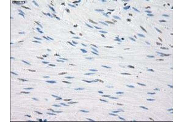 FCGR2A antibody