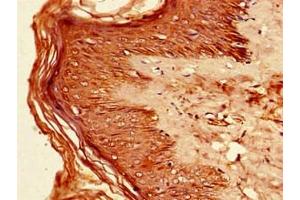 Immunohistochemistry of paraffin-embedded human skin tissue using ABIN7156631 at dilution of 1:100 (IRF7 antibody  (AA 131-289))