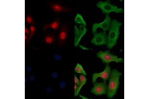 ABIN6264198 and ABIN6266655 staining Hela cells by IF/ICC.