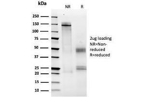 SDS-PAGE Analysis Purified MCM6 Mouse Monoclonal Antibody (MCM6/2999). (MCM6 antibody  (AA 228-368))
