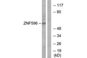 Western blot analysis of extracts from Jurkat cells, using ZNF596 Antibody. (ZNF596 antibody  (AA 261-310))