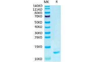 IL-15 Protein